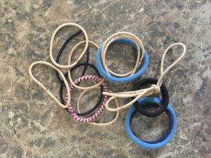 What they found in Ollie's stomach was hair ties.